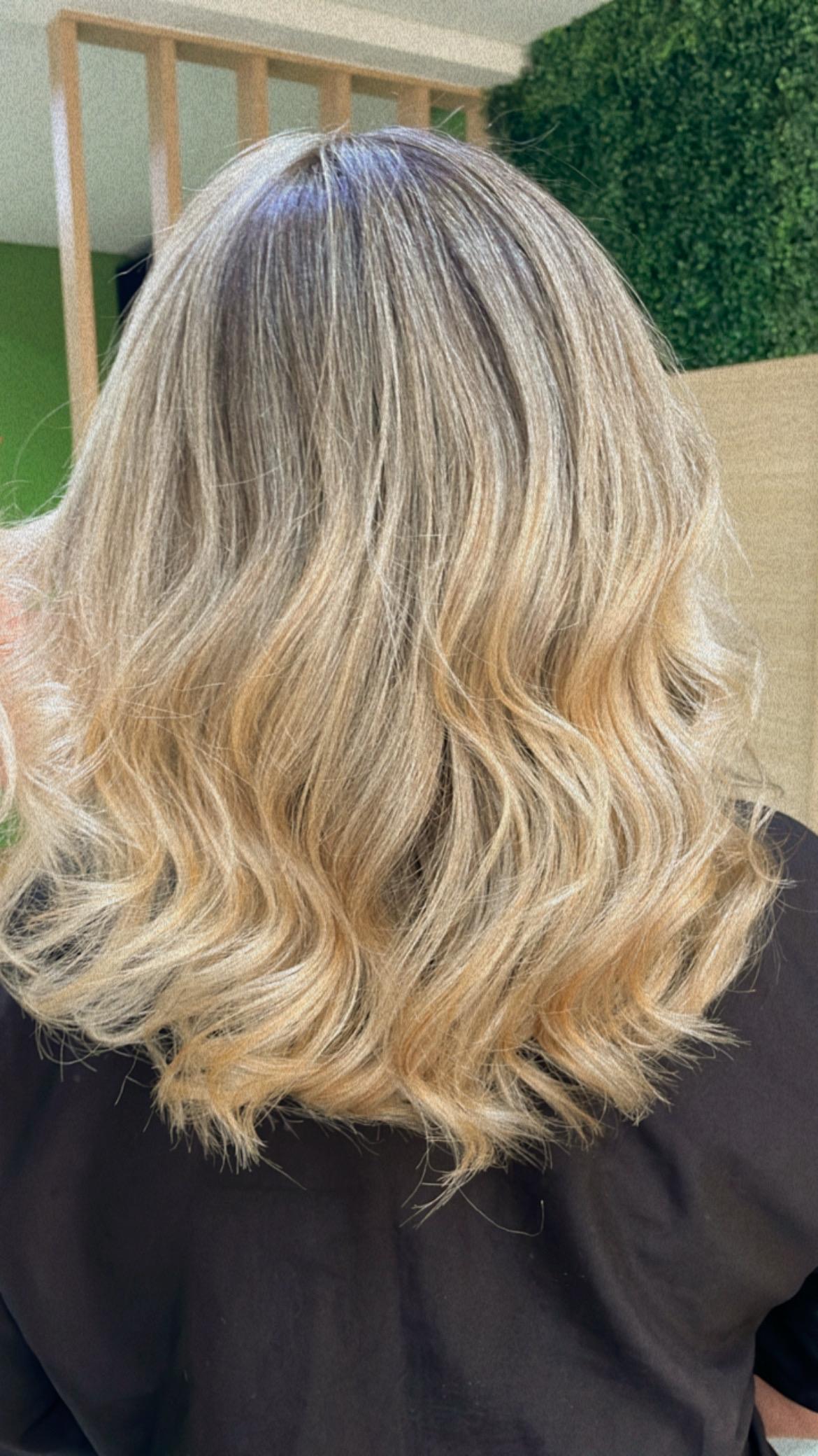 Foto depois do tratamento MarBellas