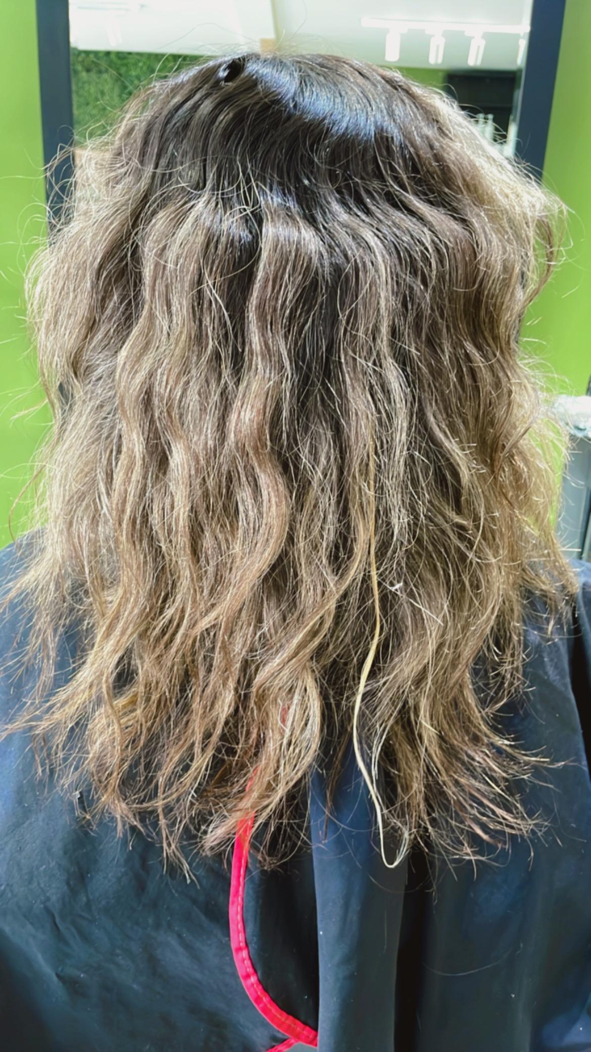 Foto antes do tratamento MarBellas